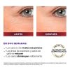 Ácido Hialurónico Sérum De Ojos L'oréal Paris Revitalift Día Noche 20ml - Imagen 8